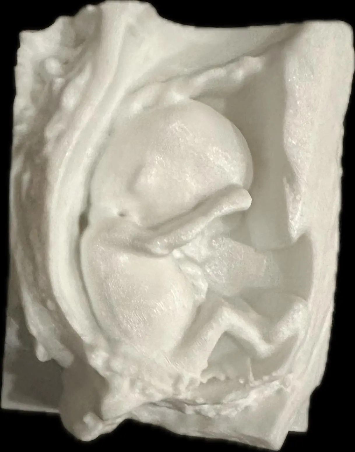 Full Fetal Model