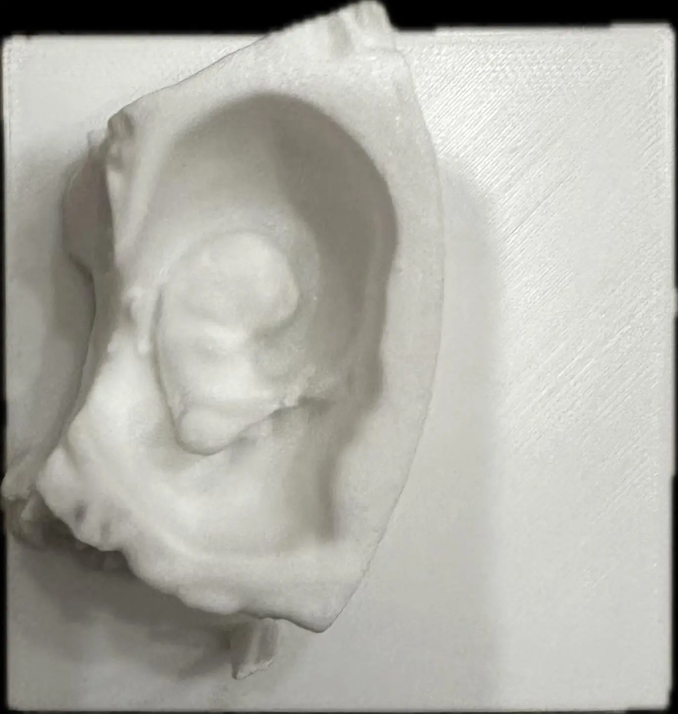 Embryo